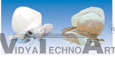 The expansion model of temporal bone